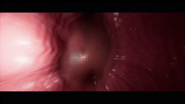 061815afku52opooz5t5mp.gif